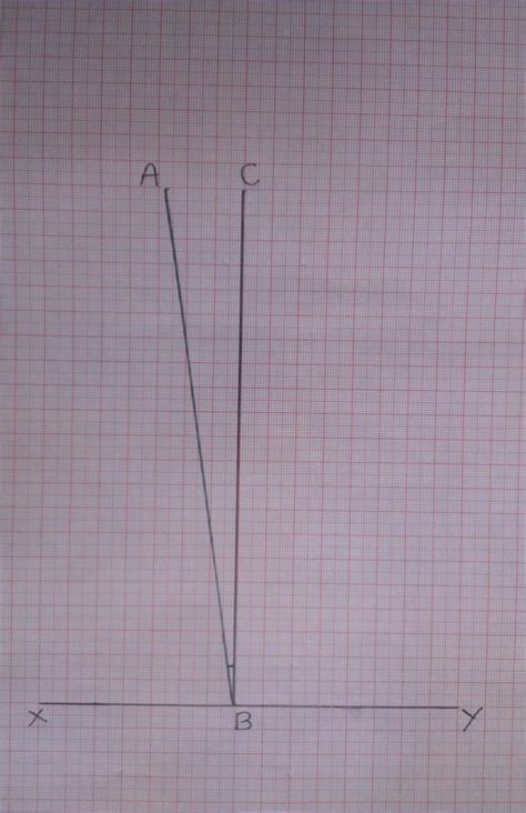 Measuring The Bicondylar Angle Of Femur Download Scientific Diagram