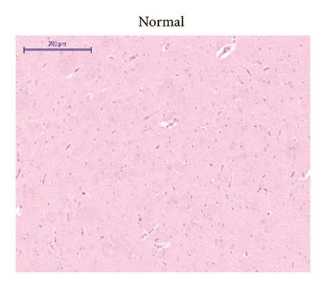 Histological Sections Of Spleen Heart And Brain Of Rats In Subacute