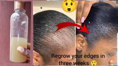 Your Edges Will Grow Like Crazy Using This Two Ingredients To Grow