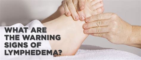 What Are The Warning Signs Of Lymphedema