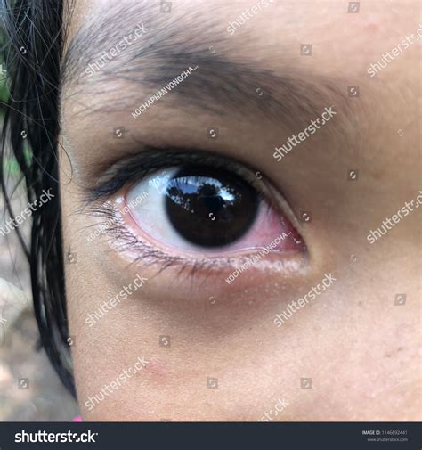 Closeup Black Eyes Asia Child Girl Stock Photo 1146692441 | Shutterstock