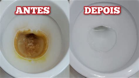 Como Tirar Amarelado Encardido Crosta E Marca D Gua Do Vaso Sanit Rio