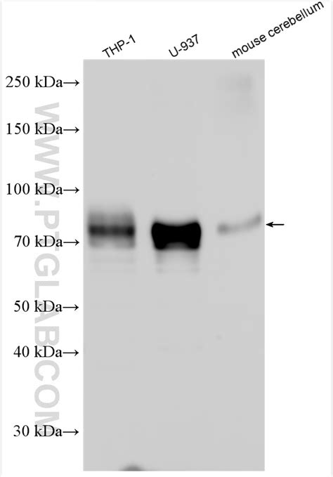 Sirp Alpha Cd A Antibody Ap Proteintech