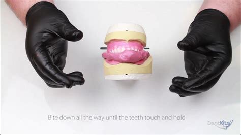 Wax Try In Reset Guide For Your Denture Dentkits Order Youtube