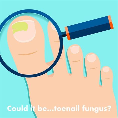 Identifying Toenail Fungus Symptoms | Nail Care Hub