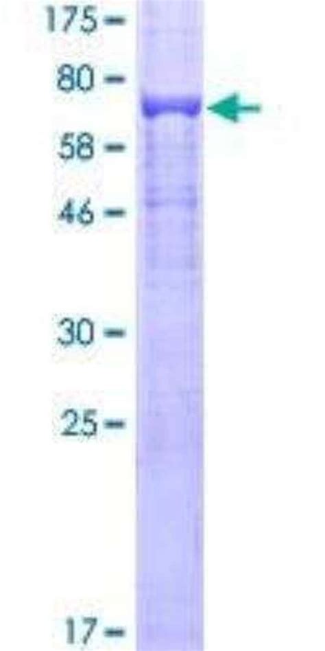 Novus Biologicals Recombinant Human Tubulin Beta Gst N Term Protein