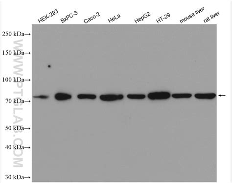 GRP78 BIP Antibody 11587 1 AP Proteintech