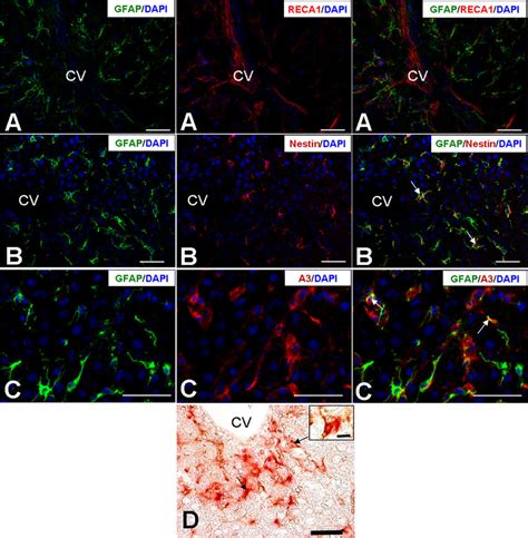 Double Immunofluorescence For Gfap Rat Endothelial Cell Antigen