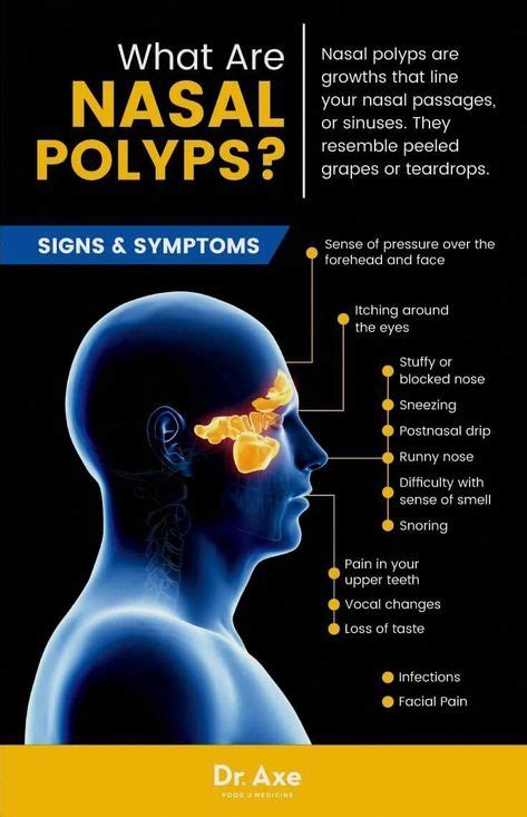 12 Polyps symptoms ideas | polyp, symptoms, sinus polyps