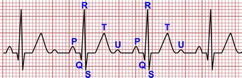 Como calcular a Frequência Cardíaca em um ECG