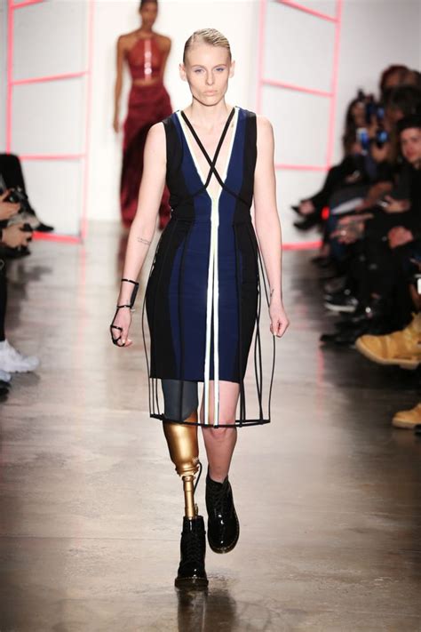 Model Who Lost Leg To Toxic Shock Syndrome Slays At Fashion Week The