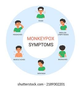 Monkeypox Virus Symptoms Infographic Medical Diagram Stock Vector