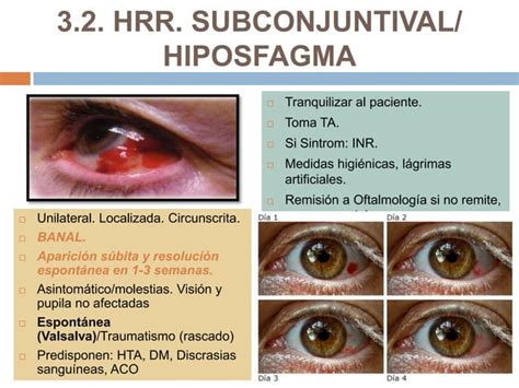 S Ntomas Oculares Sin Especificar Manejo B Sico De