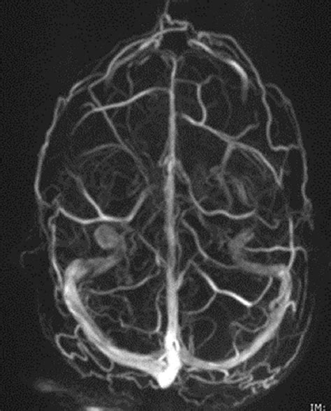 Phase Contrast Mri Physics Techniques And Clinical Applications