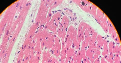 HISTOLOGIA TEJIDO MUSCULAR