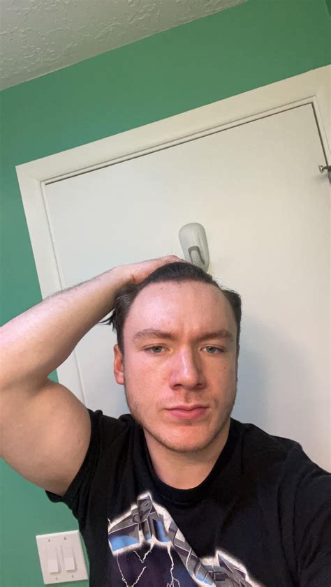 Is My Forehead Too Big For A Buzz Cut Rmalehairadvice