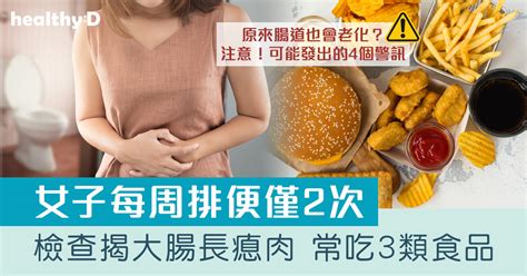 便秘解決｜27歲女子愛吃3類食品每周排便2次 大腸鏡檢查揭長瘜肉