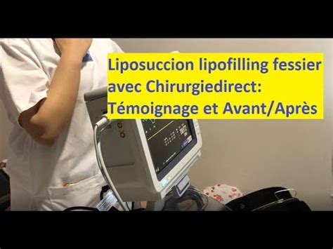 Chirurgie Esth Tique Tunisie Liposuccion Et Lipofilling Fesses Avec