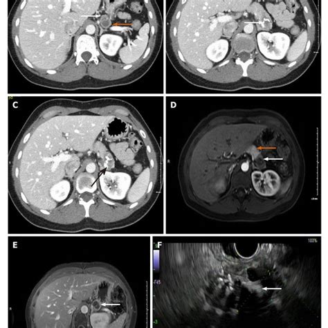 Abdominal Computed Tomography Angiography A Computed Tomography Download Scientific Diagram