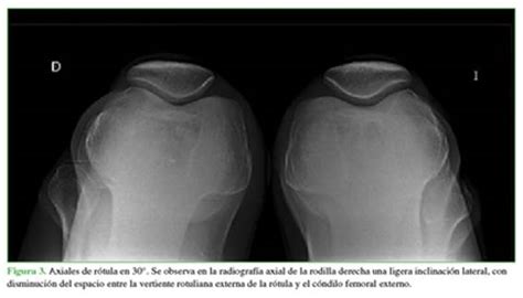 Sesolicitaron Radiograf As En El Frente Y Perfil Que Fueron Negativas