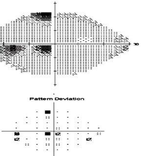 Field changes in a patient showing a central scotoma in the left eye ...