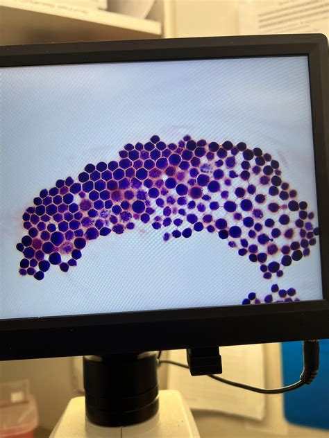 Csf Gram Stain Pt 2 R Medlabprofessionals