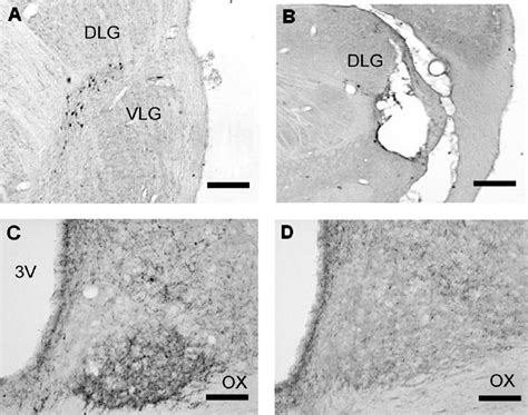 Representative Photomicrographs Showing NPY Ir Cell In The IGL A B