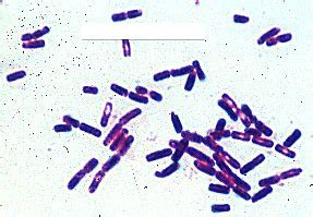 Streptococcus Salivarius Capsule Stain