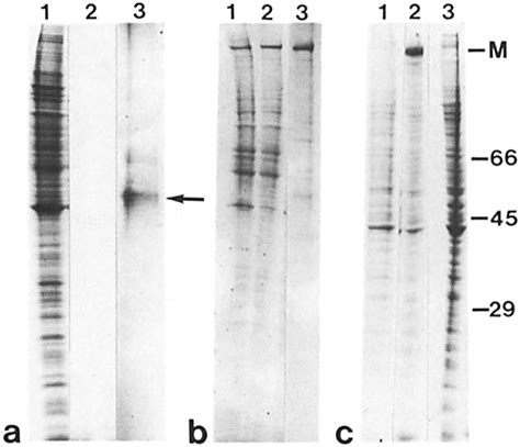 Myosin Precipitation From Extracts Depleted Of K A Lane