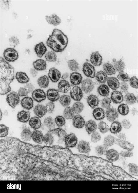 Aids Virus Transmission Electron Micrograph Tem Of A T Lymphocyte