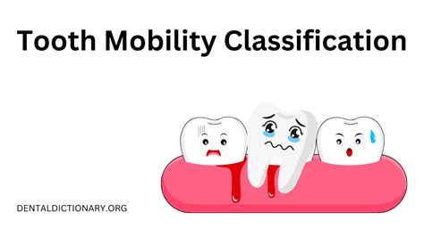 Tooth Mobility Classification In Periodontal Patients Dental Dictionary