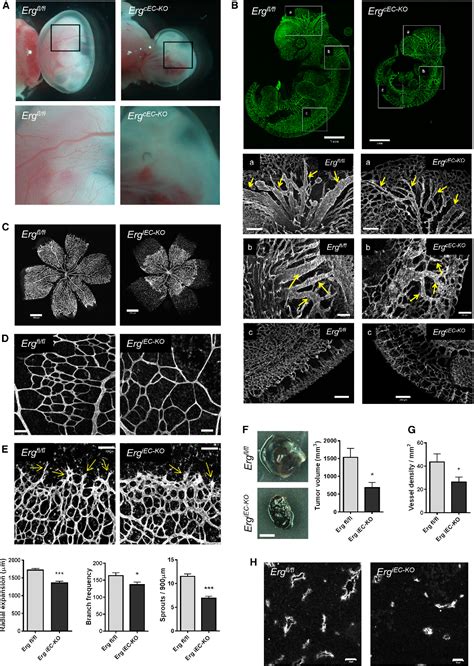 Figure 1 From The Endothelial Transcription Factor ERG Promotes