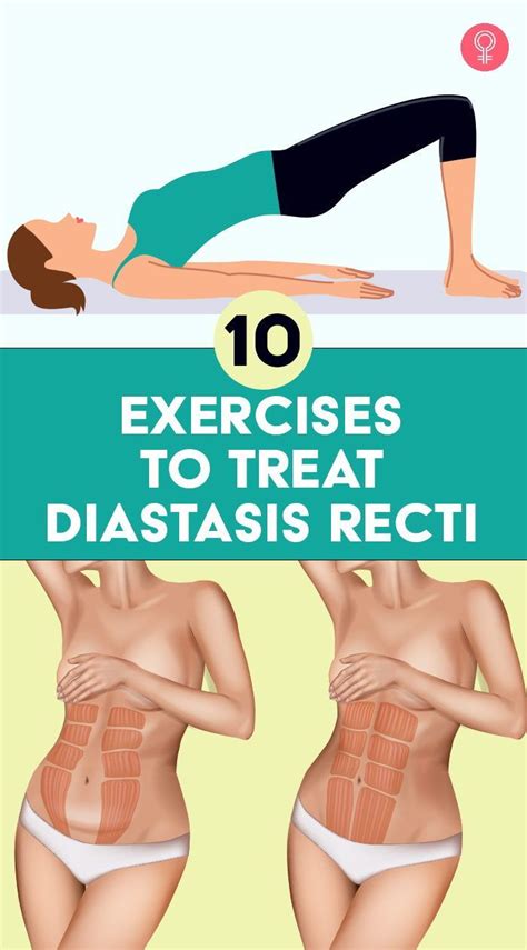 10 Exercises For Diastasis Recti That Strengthen Your Core Artofit