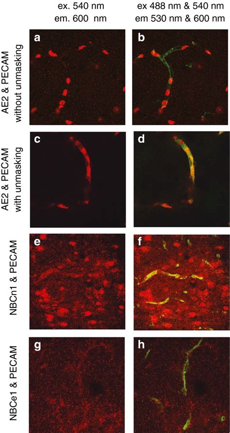 Confocal Images Of Dual Immunofluorescence Staining For AE2 Or NBCe1 Or