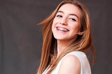 What To Consider With Metal Braces Orthodontic Treatment