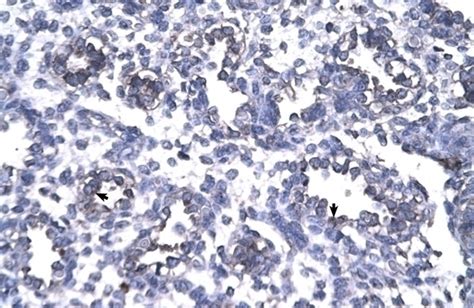 Foxp1 Antibody Cat No 27 635 Prosci