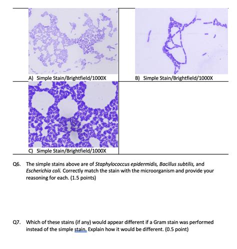 Solved A) Simple Stain/Brightfield/1000X B) Simple | Chegg.com