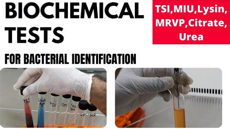 Biochemical Tests For Bacterial Identification Part Tsi Miu Mr Vp