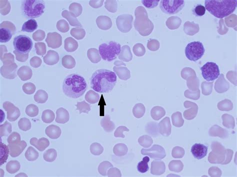 10.1: Granulocytes and Granulocyte Maturation - Medicine LibreTexts