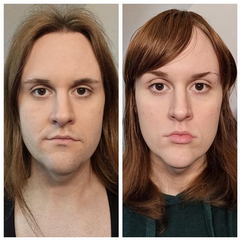 8 Months Of Hrt 2 3 Year Done Final 1 3 For The 1 Year Mark R Transtimelines