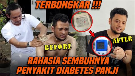 RAHASIA PANJI BISA SEMBUH DARI DIABETES YouTube