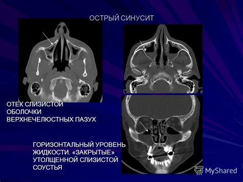 Презентация на тему: "КОМПЬЮТЕРНАЯ ТОМОГРАФИЯ в исследовании ...