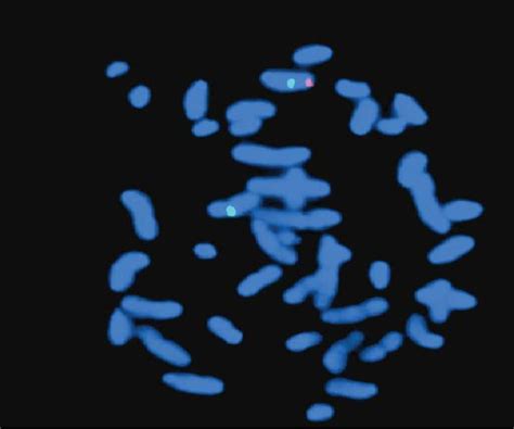 Fluorescent In Situ Hybridization Analysis For Sample 34 Showing 2 Download Scientific Diagram