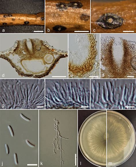 Cytospora Rusanovii On Salix Babylonica Mflu Holotype A