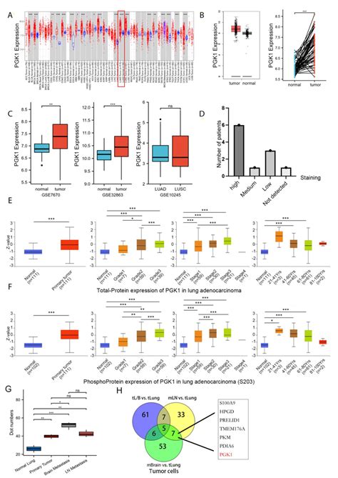 Pgk Expression Levels In Pan Cancer And Luad Contexts A From The