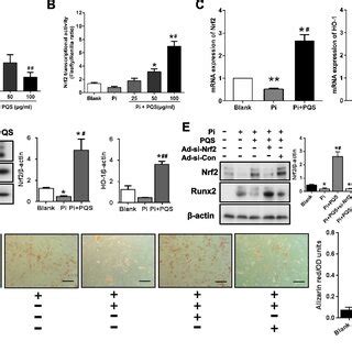 PQS Attenuates High Phosphate Induced Vascular Smooth Muscle Cell