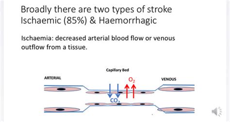 Stroke Lecture Flashcards Quizlet