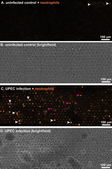 Figures And Data In Dynamic Persistence Of UPEC Intracellular Bacterial