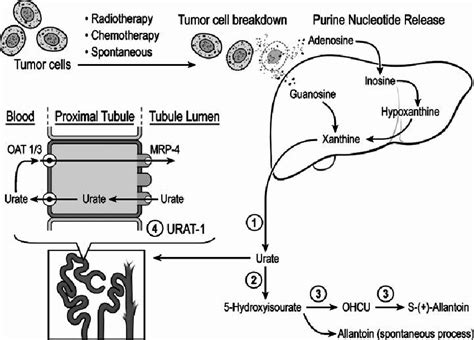 Diagram Showing Urate Handling During Tumor Lysis Syndrome As Affected