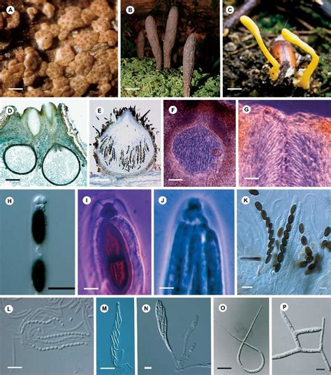 Morphology Of Species In The Sordariomycetes A Hypocrea Lutea BPI